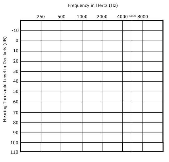 Printable Blank Audiogram Form Printable Forms Free Online